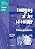Imaging of the Shoulder: Techniques and Applications (Medical Radiology)