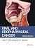 Oral and Oropharyngeal Cancer