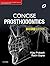 Concise Prosthodontics, 2nd...