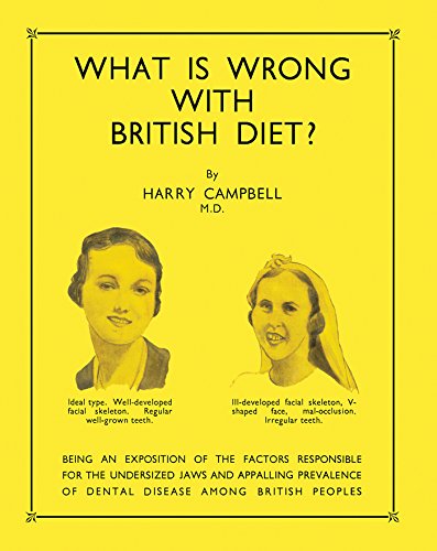 What Is Wrong with British Diet?: Being an Exposition of the Factors Responsible for the Undersized Jaws and Appalling Prevalence of Dental Disease Among British Peoples (Kindle Edition)