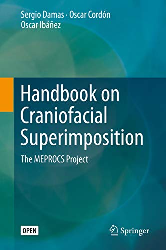 Handbook on Craniofacial Superimposition: The MEPROCS Project (Kindle Edition)