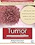Tumor in 7 Days  by R. Rajamahendran