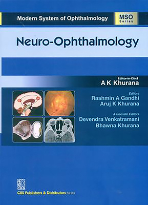 Neuro-Opthalmology (Modern System of Opthalmology)