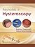 Keynotes in Hysteroscopy