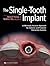 The Single-Tooth Implant:: A Minimally Invasive Approach for Anterior and Posterior Extraction Sockets