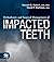 Orthodontic and Surgical Management of Impacted Teeth