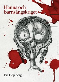 Hanna och barnsängskriget (Hardcover)