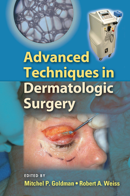 Advanced Techniques in Dermatologic Surgery (Kindle Edition)
