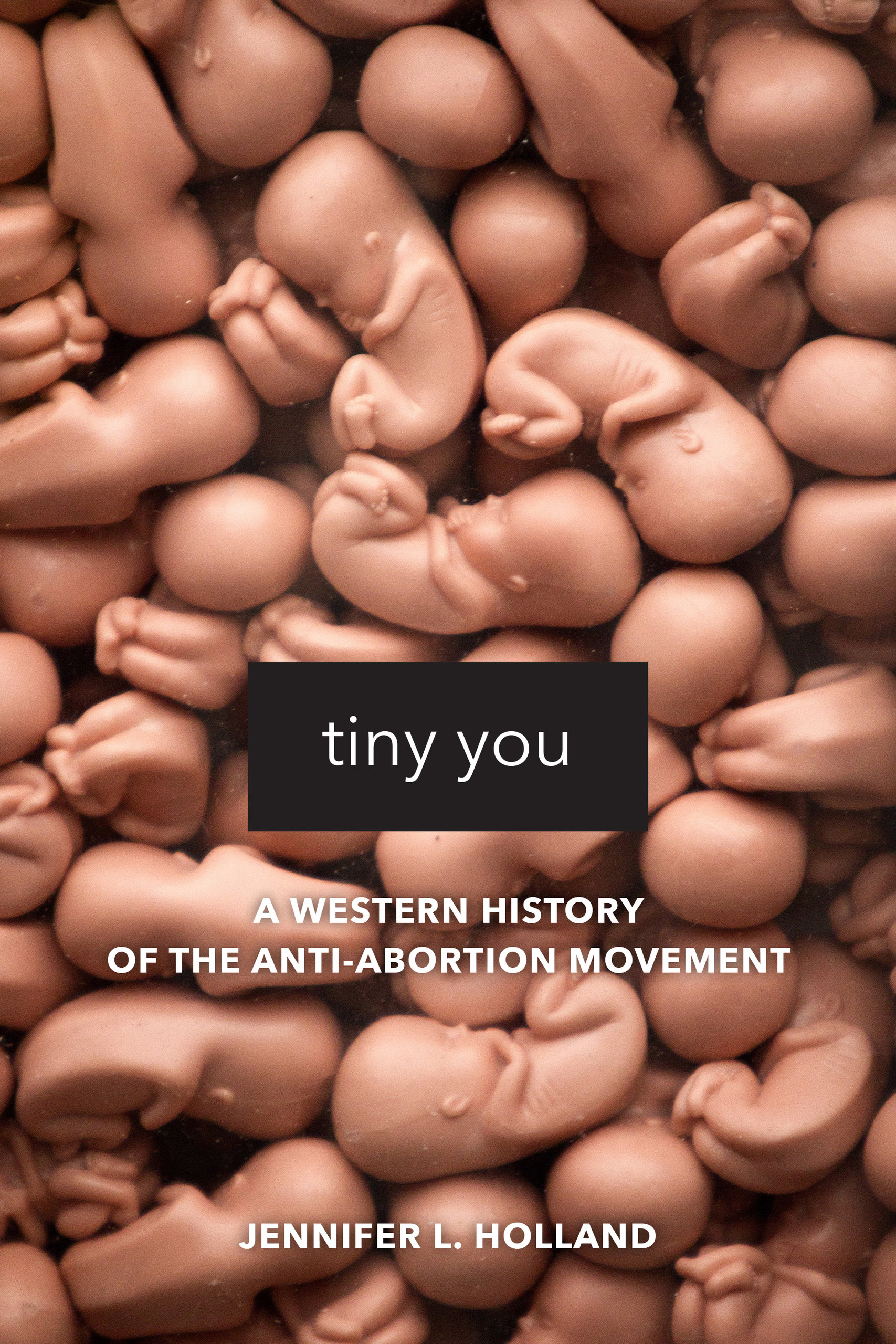 Tiny You: A Western History of the Anti-Abortion Movement (Hardcover)