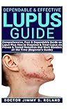 Dependable & Effective Lupus Guide: Comprehensive, Fast & Dependable Guide on Lupus Plus How to Diagnose & Treat Lupus Via Proven & Tested Remedies That Work Wonders All the Time (Beginner's Guide)