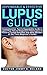 Dependable & Effective Lupus Guide by Jimmy S. Roland
