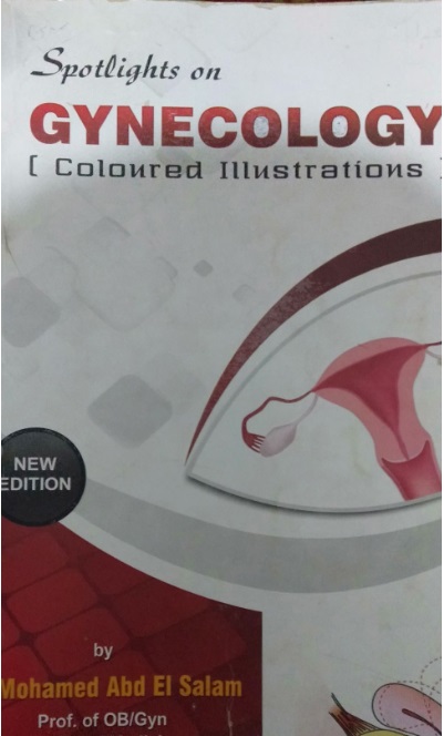 Spotlights on GYNECOLOGY : COLOURED ILLUSTRATIONS (Paperback)