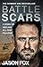 Battle Scars: A Story of War and All That Follows