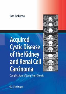 Acquired Cystic Disease of the Kidney and Renal Cell Carcinoma: Complication of Long-Term Dialysis