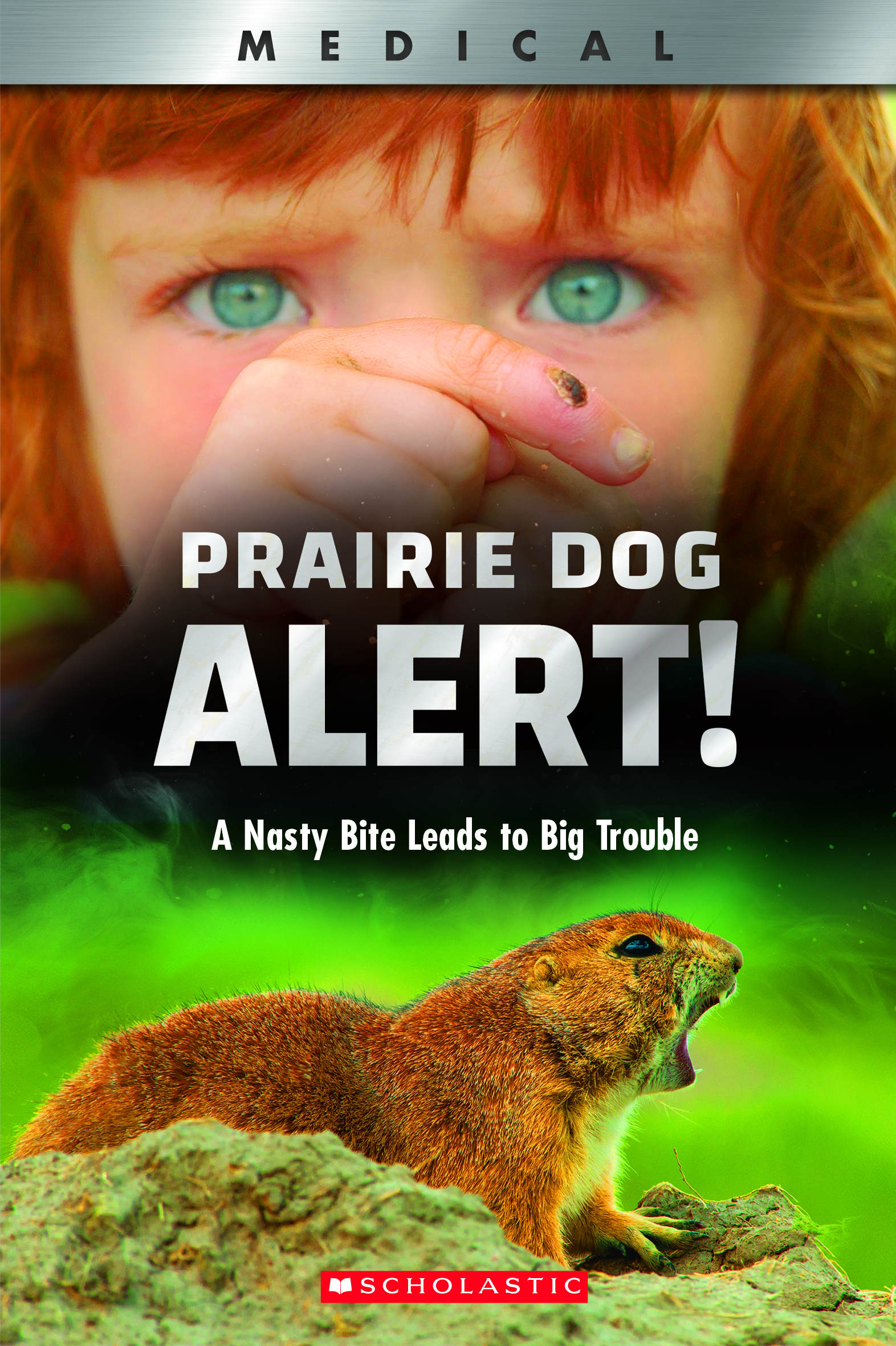 Prairie Dog Alert!: A Nasty Bite Leads to Big Trouble (XBooks)