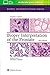 Biopsy Interpretation of the Prostate (Biopsy Interpretation Series)