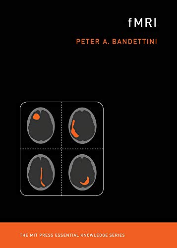 fMRI (Kindle Edition)