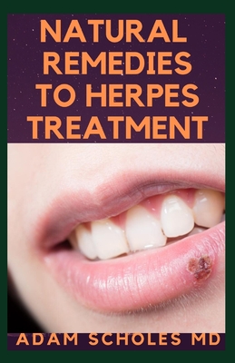 NATURAL REMEDIES TO HERPES TREATMENT: The Complete Guide On Treating Herbs Naturally