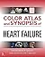 Color Atlas and Synopsis of Heart Failure (Color Atlas and Synopsis of Heart Failure, 1)