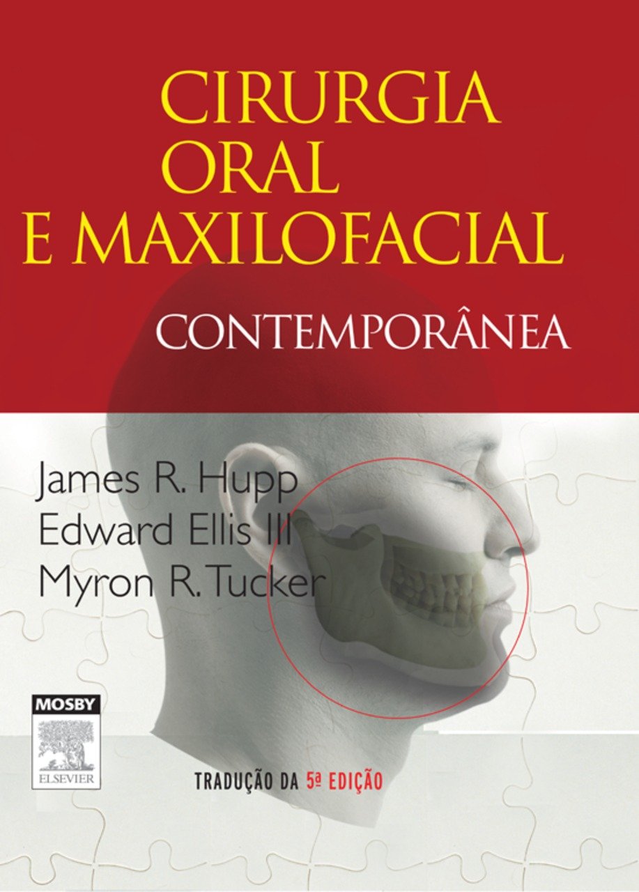 Cirurgia Oral E Maxilofacial Contemporanea
