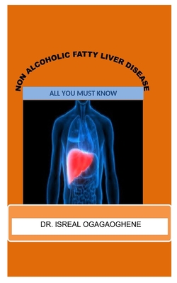 Non alcoholic fatty liver disease: All you must know