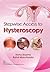 Stepwise Access to Hysteroscopy