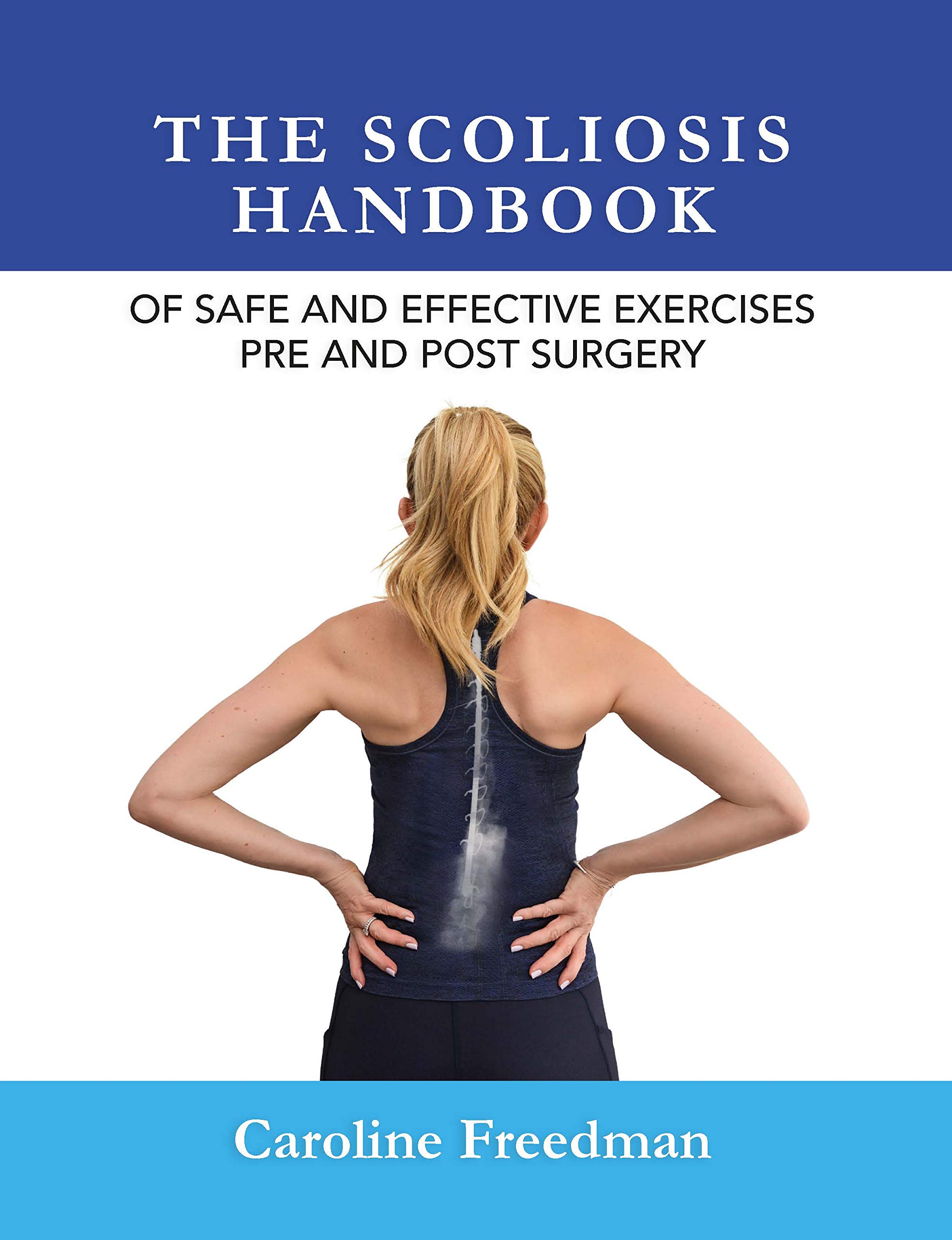 The Scoliosis Handbook (Paperback)