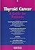 Thyroid Cancer by Douglas Van Nostrand
