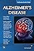 Alzheimer's Disease (MyModernHealth FAQs)