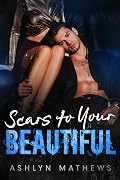 Scars to Your Beautiful