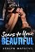 Scars to Your Beautiful