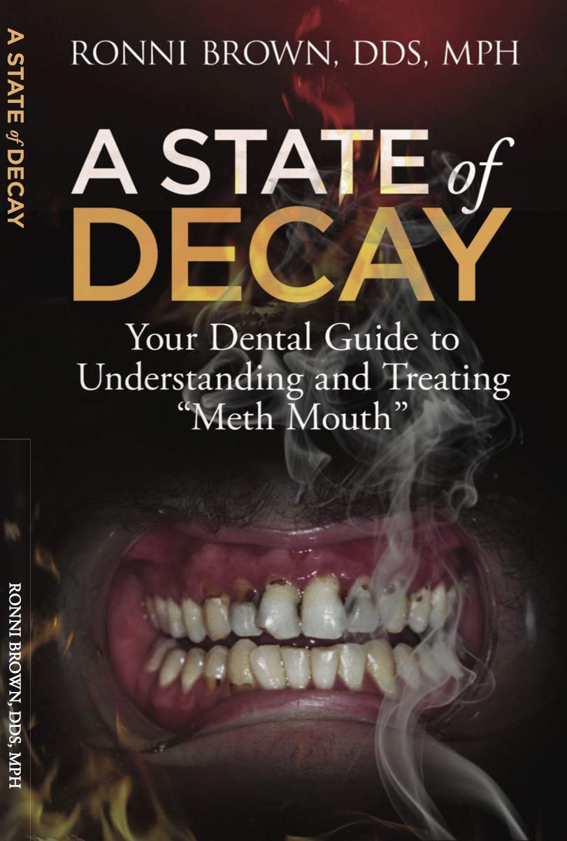A State of Decay: Your Dental Guide to Understanding and Treating "Meth Mouth" (Kindle Edition)