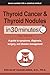 Thyroid Cancer and Thyroid ...