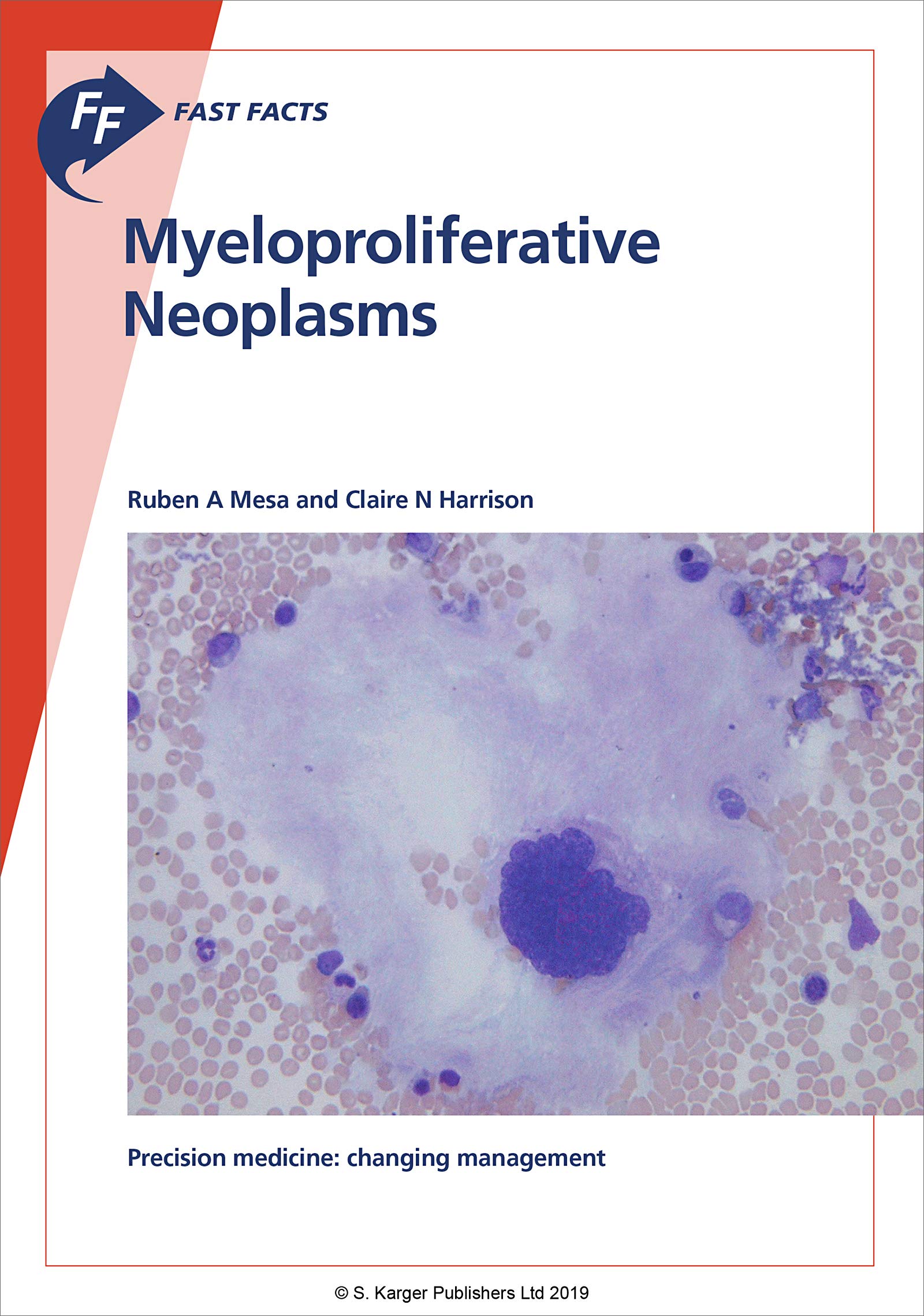 Fast Facts: Myeloproliferative Neoplasms (Kindle Edition)