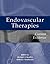 Endovascular Therapies by Michael G. Wyatt