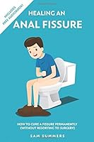 healing an anal fissure how to cure a fissure permanently by sam summers