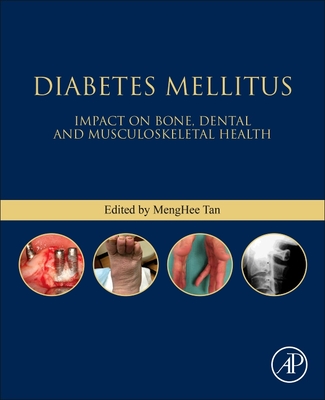 Diabetes Mellitus: Impact on Bone, Dental and Musculoskeletal Health (Bones, Joints, and Hormones series)