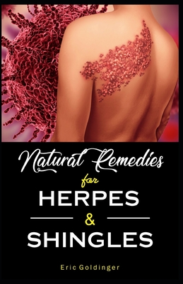 Natural Remedies For HERPES & SHINGLES: The Complete Guide