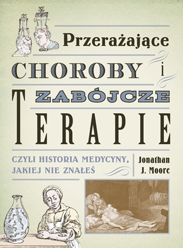 Przerażające choroby i zabójcze terapie, czyli historia medycyny jakiej nie znałeś