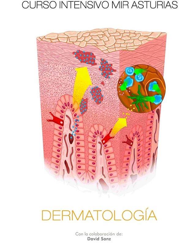 Manual Curso Intensivo MIR Asturias. Dermatología