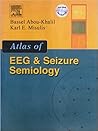 Atlas of EEG & Seizure Semiology