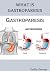 WHAT IS GASTROPARESIS