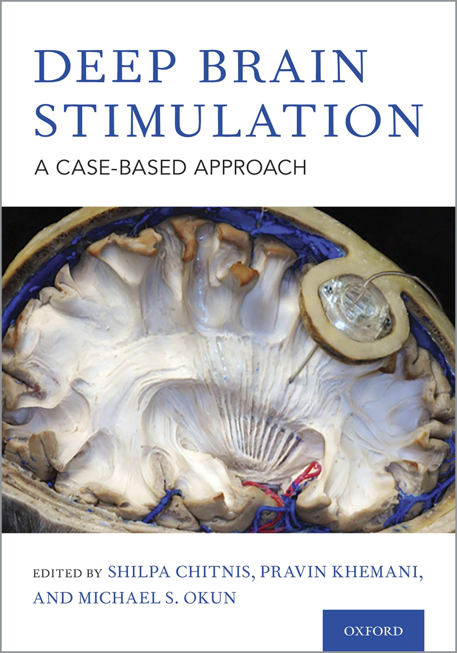 Deep Brain Stimulation: A Case-based Approach (Kindle Edition)