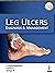 Leg Ulcers by S. Sacchidanand