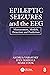 Epileptic Seizures and the EEG: Measurement, Models, Detection and Prediction