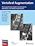 Vertebral Augmentation: The Comprehensive Guide to Vertebroplasty, Kyphoplasty, and Implant Augmentation