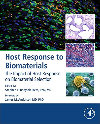 Host Response to Biomaterials: The Impact of Host Response on Biomaterial Selection