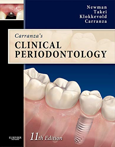 Carranza's Clinical Periodontology Expert Consult: Text with Continually Updated Online Reference (Newman, Carranza's Clinical Periodonyology) by Michael G. Newman DDS, Saunders