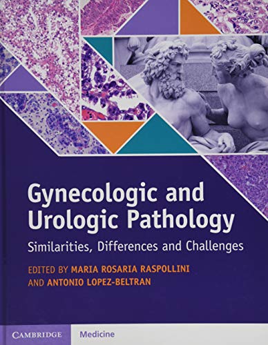Gynecologic and Urologic Pathology: Similarities, Differences and Challenges by , Cambridge University Press