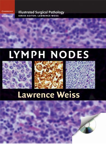 Lymph Nodes (Cambridge Illustrated Surgical Pathology) by Lawrence M. Weiss, Cambridge University Press